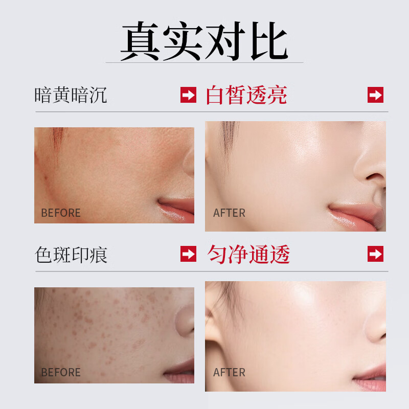 韩伦美羽美白祛斑精华液提亮肤色暗沉去色斑雀斑黄褐斑晒斑斑点补水保湿 【两瓶】美白祛斑精华液（红白款） 30ml x 2瓶