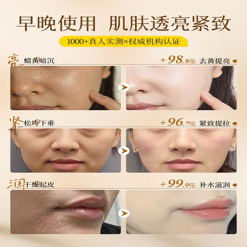润凰黄芪霜100%正品老牌国货去黄提亮补水保湿抗皱抗衰老面霜男女可用 5盒 共250g【弹嫩透亮 无惧反黄】