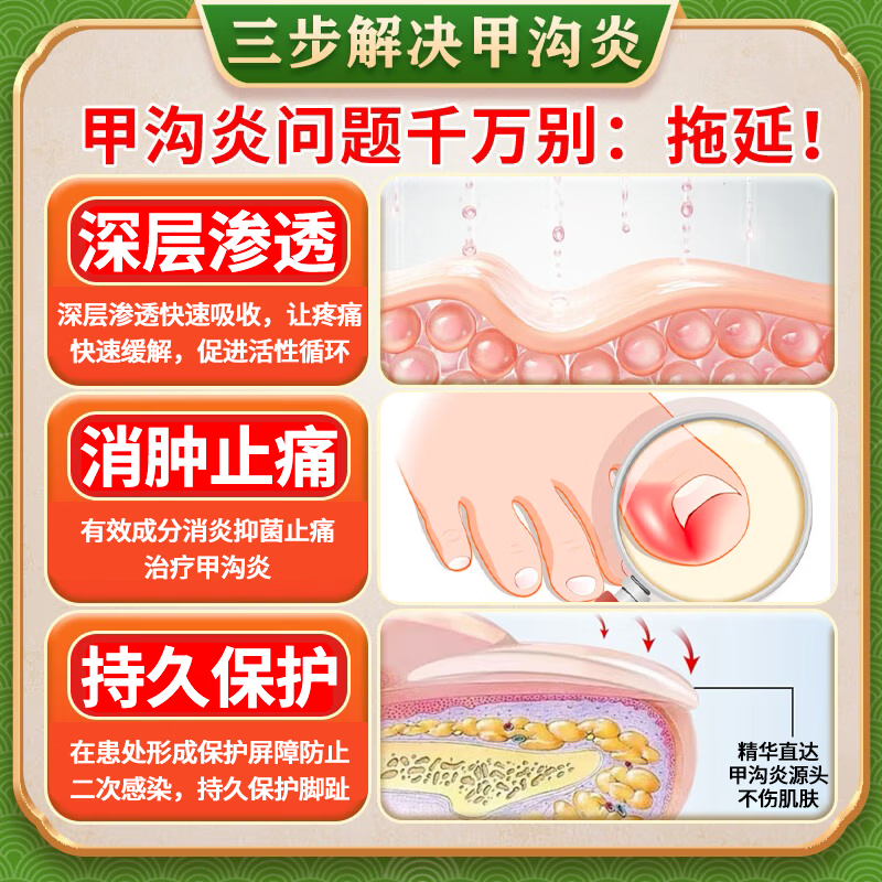 [华青]克霉唑乳膏 10g 1盒装 甲沟炎专用去药根部治脚趾甲往肉里长消肿止痛去肉芽治严重息肉外用消炎药【视觉特效】 +1盒溶液 消肿止痛 无需拔甲