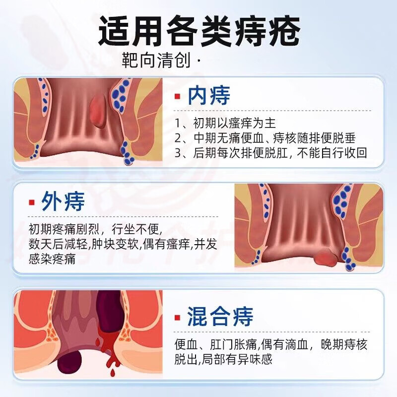 熏姿颜季诺升痔疮凝胶医用肉球肛裂便血肿胀内外混合痔无痛敷料男女正品 五支装 重度肛裂便血 官方自售