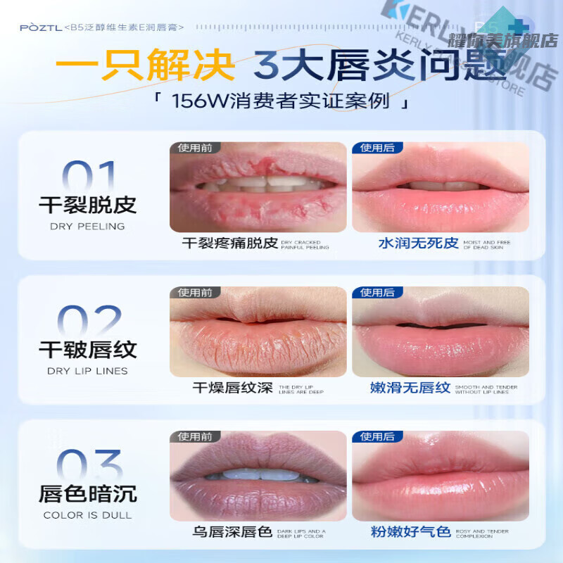 LUJAHA南袖柚护唇套装保湿补水滋润舒护唇部敏感日护夜养唇膏唇部精华 买三赠二 5支装【孕婴幼安心可用】 官方直售