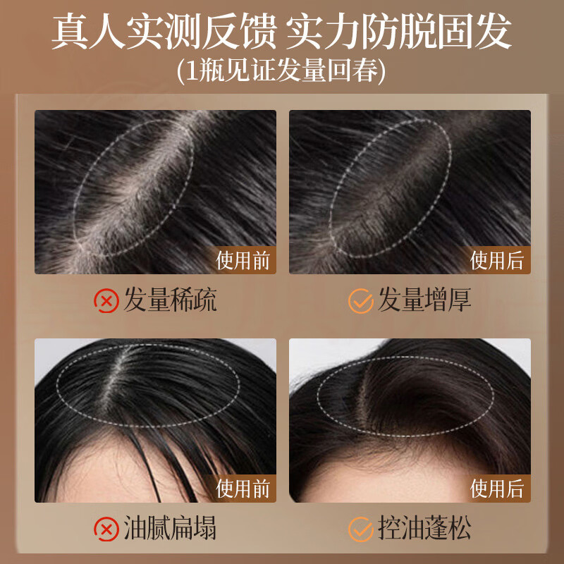 熏姿颜康迪生防脱洗发水固发育发控油蓬松丰盈柔顺草本植萃营养强韧发根 5瓶装【重度脱发必选】 官方直售