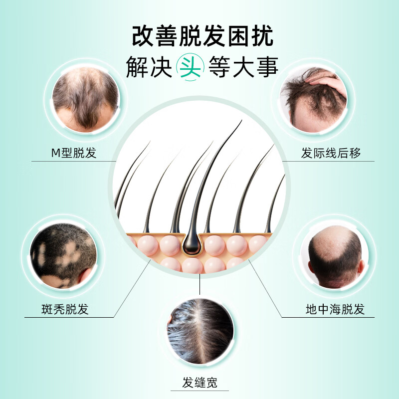 [史云逊（Svenson）]米诺地尔搽剂 5%*60ml 1盒装 5%*60ml/盒治脱生发清爽治脱发育发生发 标准装