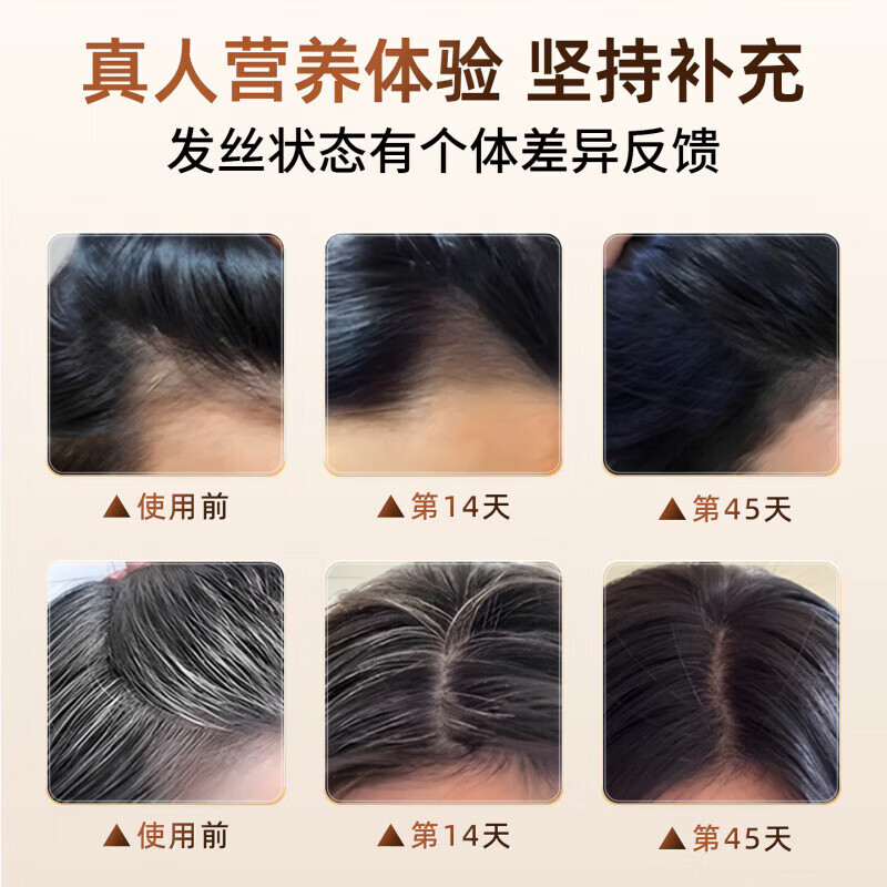 胖中来卫蒽维生素b族乌发素莱乌发b族白发脱发生物素胶囊黑发养发男女 42g*2盒