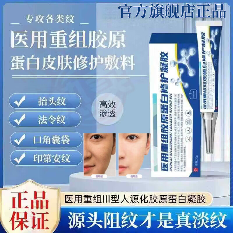 MRYU舒活宜凝胶祛法令纹颈纹医用硅酮凝胶提拉修护紧致肌肤官方旗舰店 1支 体验装 官方自售