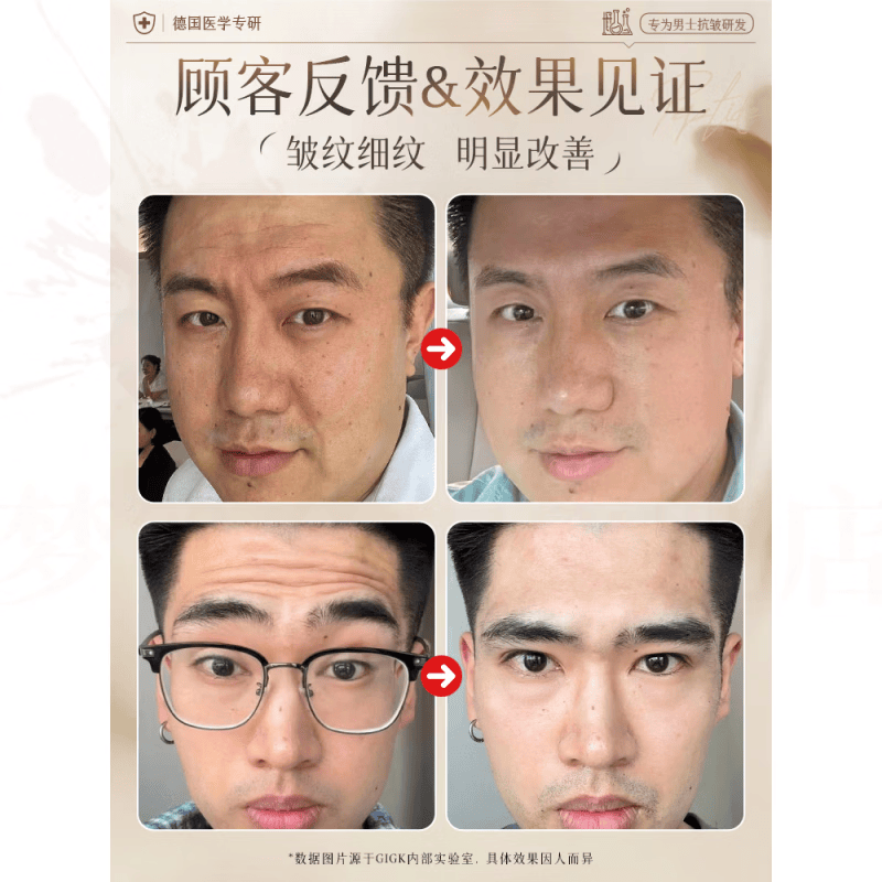 倾兮绯悦紧致抗皱面霜紧致抗皱抗衰老法令纹抬头纹眼周细纹全脸紧致 5瓶装 焕亮紧致 抗氧抗老 品牌直售