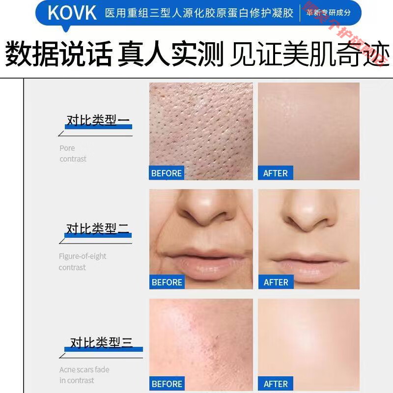灵眷仙zata护理膜医用胶原蛋白kovk凝胶zott修复凝胶屏障修护官方旗舰 1支【体验装】 【官方直售 京健保障】