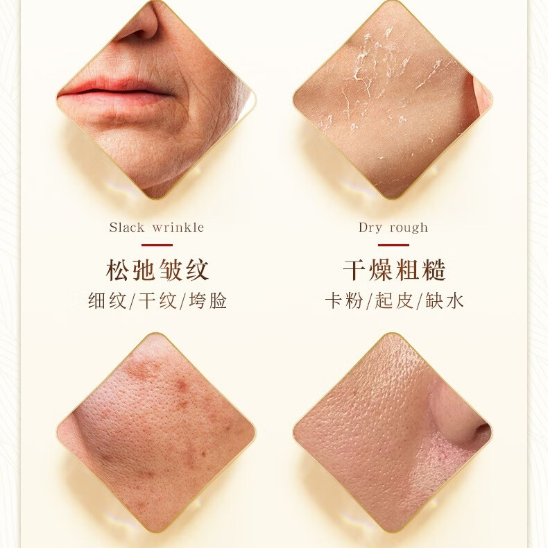 欧佩美白祛斑六件套可减轻斑点盈润肌肤提亮肤色美白护肤套盒