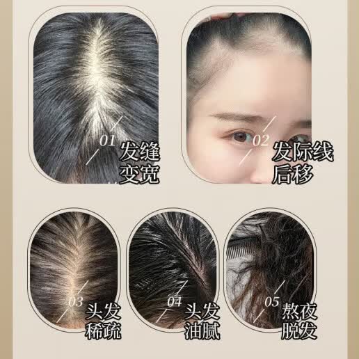 YTYU丁达育发液中药防脱育发固发养发洗发水脱发滋养强发根老姜何首乌 三瓶【发量猛涨】 300ml   