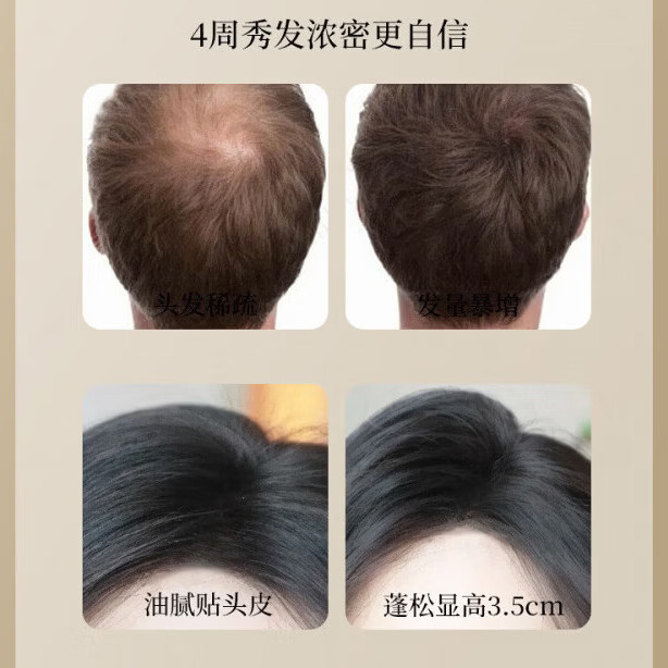 YTYU丁达育发液中药防脱育发固发养发洗发水脱发滋养强发根老姜何首乌 三瓶【发量猛涨】 300ml   