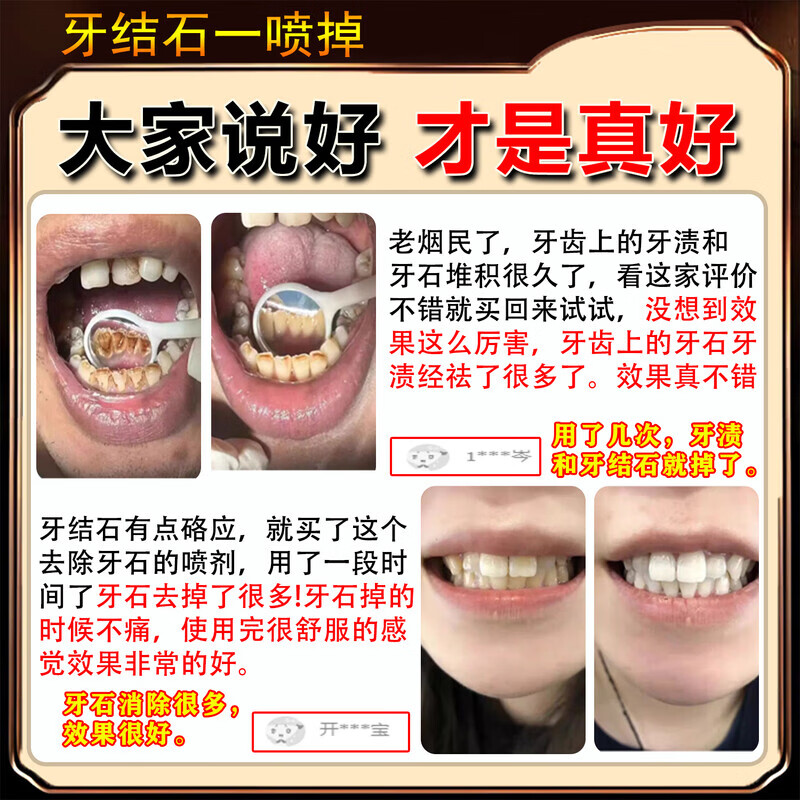 香港大药房牙结石清理神器溶解液去牙垢牙结石清除速效清理神器口臭去黄喷雾 5盒：（结石不再来）买3送2
