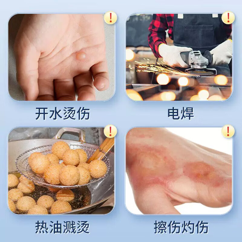 颜盾烫伤修复膏烧伤专用草本研制修护褥疮康复专用红肿起泡不留疤痕 三盒装买2送1(中度实用,不好可退)