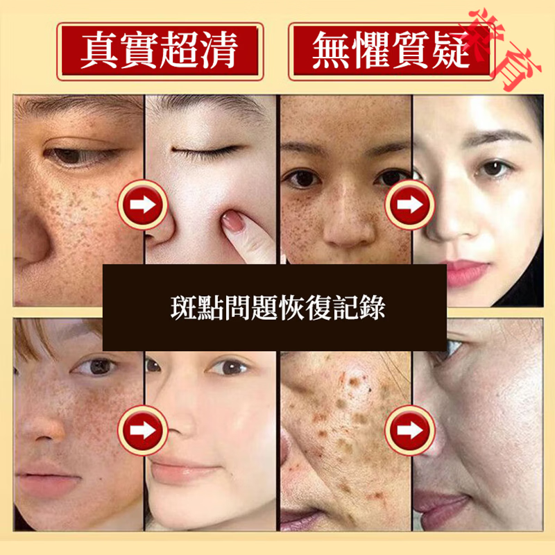 BEIYVS印度檀香木祛斑皂进口淡斑专用天然木质香手工皂洗澡洗脸精油皂 五块装 官方直售