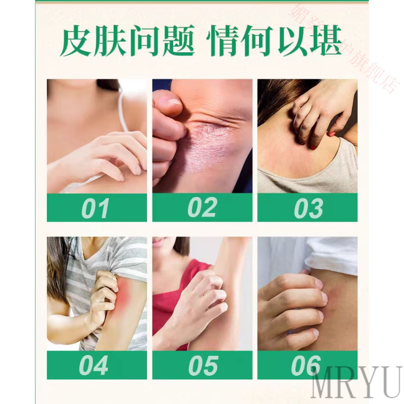 灵眷仙皮炎宁酊水正品老牌子正牌外用皮肤膏内蒙古大唐止痒抑菌液痒灵丁 一盒【体验装】 【官方直售 京健保障】