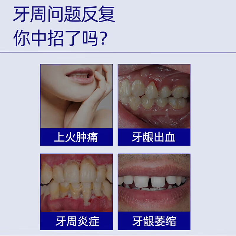 三金西瓜霜牙膏清焱护龈清新口气抗敏镇疼深层清洁护龈健齿男女士牙膏 【清焱护龈牙膏】两支优惠装
