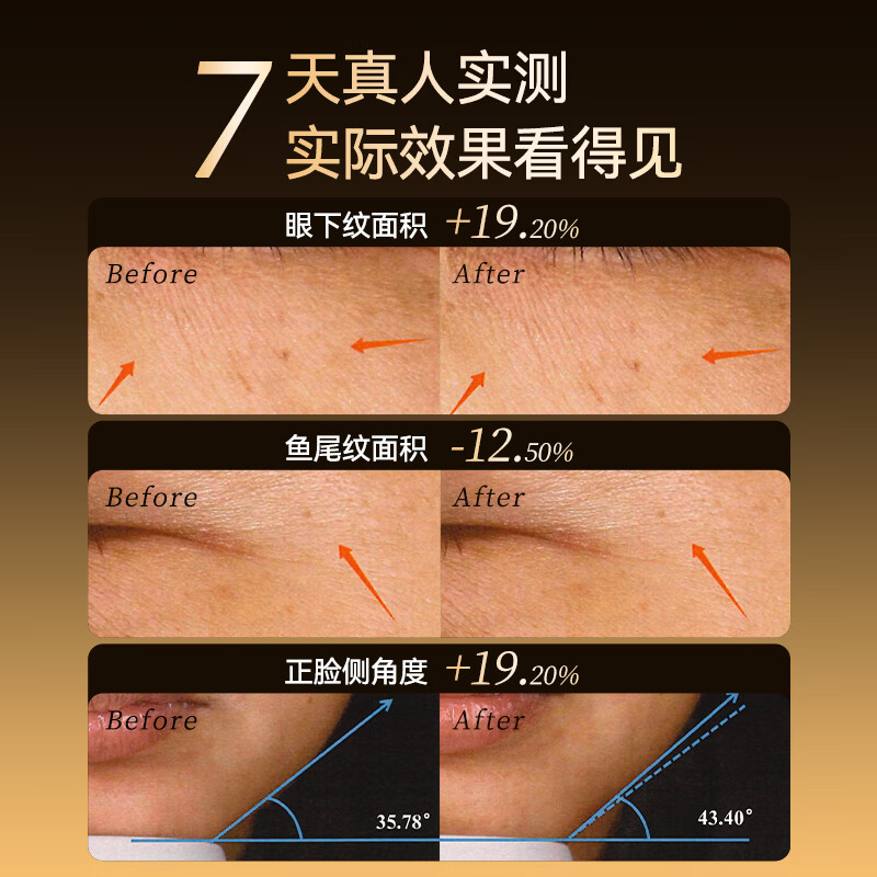 HYUNDAI超模刀美容仪淡纹肌肉膜抗衰家用脸部按摩仪提拉紧致v脸神器嫩肤瘦脸固发生日礼物送女友老婆 【全能顶奢充电款】紧致V脸+美唇+亮眼+健发+塑形
