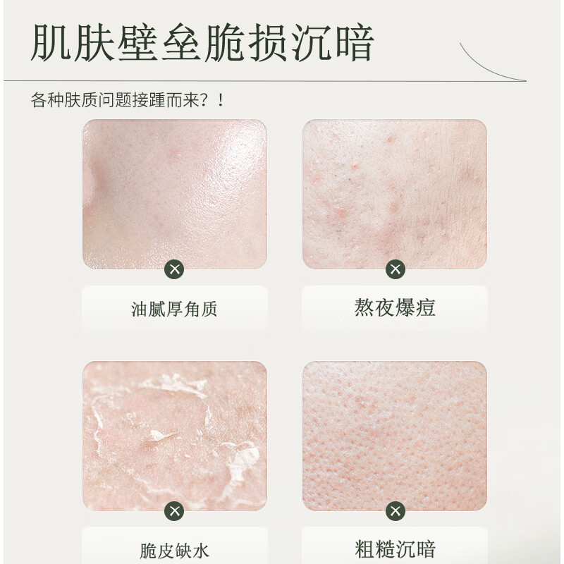 OPOSi山茶花水乳套装补水保湿面霜去黄提亮控油乳液平价护肤品全套学生 （四件套）水+乳+洗面奶+面霜