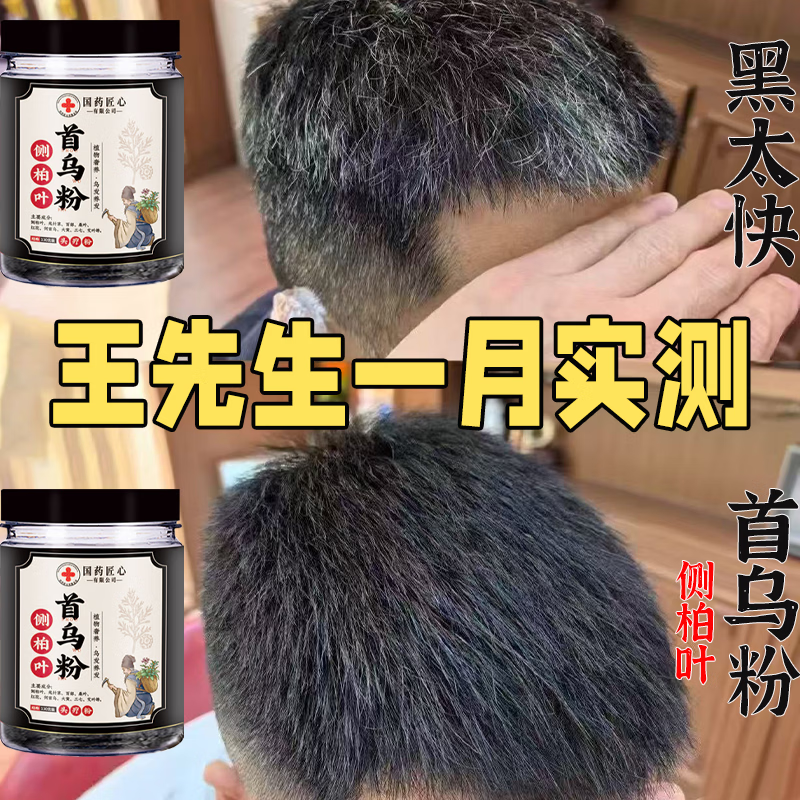 示博士【国货正品】国药匠心何首乌侧柏叶新款洗发粉黑发养发头皮护理 拍1发5【大面积白发】店长主推