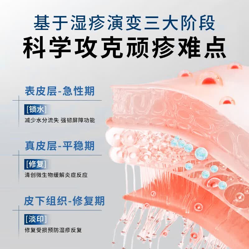 同仁堂【一抹止痒】抑菌止痒药膏皮肤瘙痒皮炎湿疹干燥真菌感染越抓越痒 1支【温和不刺激】一抹止痒 皮肤湿疹膏止痒抑菌皮肤瘙痒去顽固湿毒