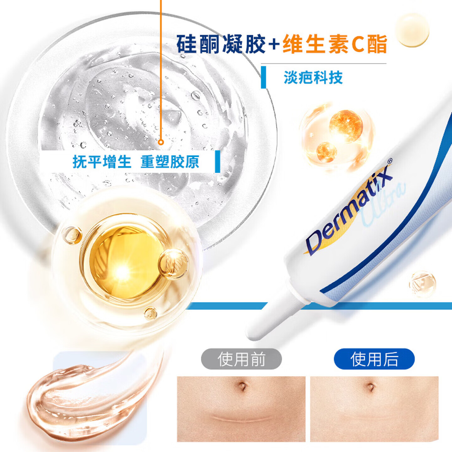 倍舒痕儿童祛疤膏修复硅凝胶手术烫伤摔划增生Dermatix小恐龙7g 倍舒痕成人30g+4g【大面积/增生性疤痕护理】