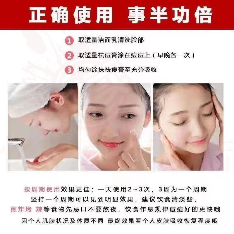 MRYU雪完美祛痘无印精华液去青春痘粉刺女男士学生痘印闭口痘痘膏凝胶 5支装 官方自售