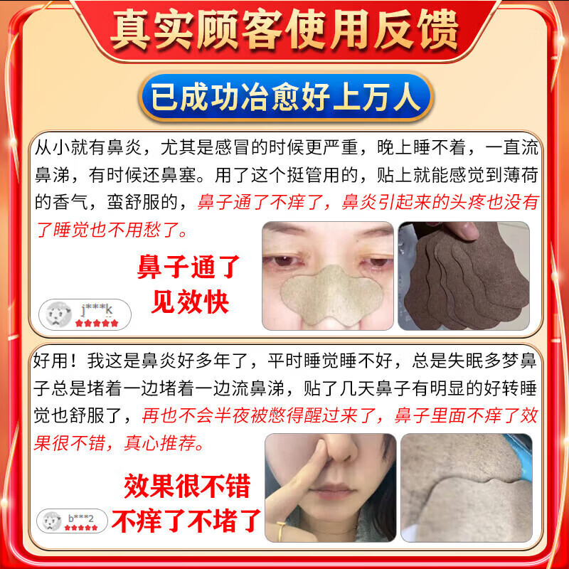 同仁堂鼻炎鼻贴过敏性鼻炎鼻窦炎贴鼻塞鼻痒治根穴位贴儿童成人专用膏药 100%特效:1盒装【北京同仁堂】