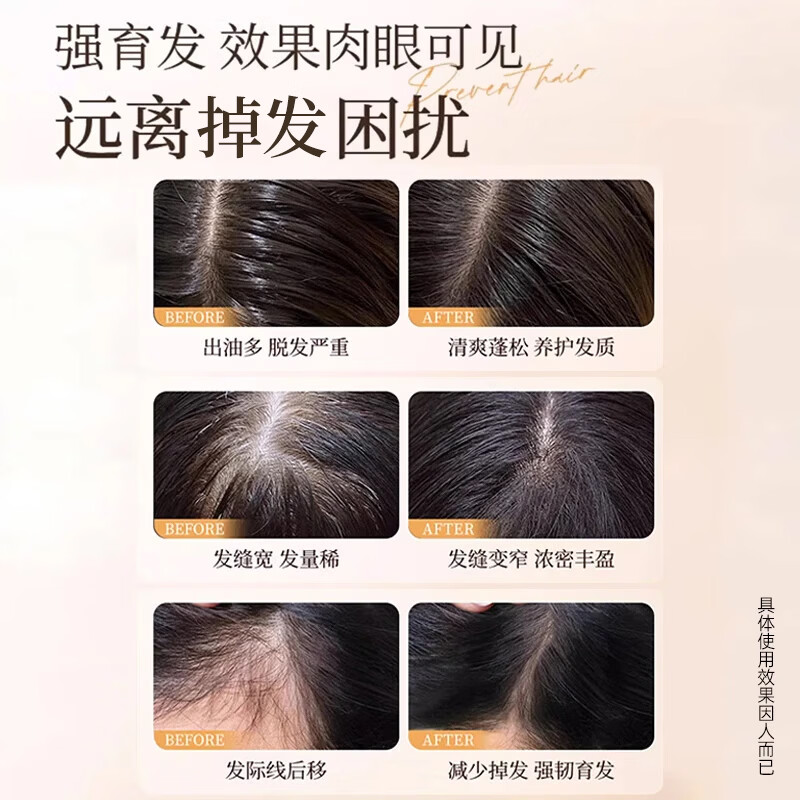青幽堂苗坚防脱洗发水强韧育丰盈发际线洗发露控蓬松不油腻男女青幽棠 【建议多瓶使用】洗发水400g