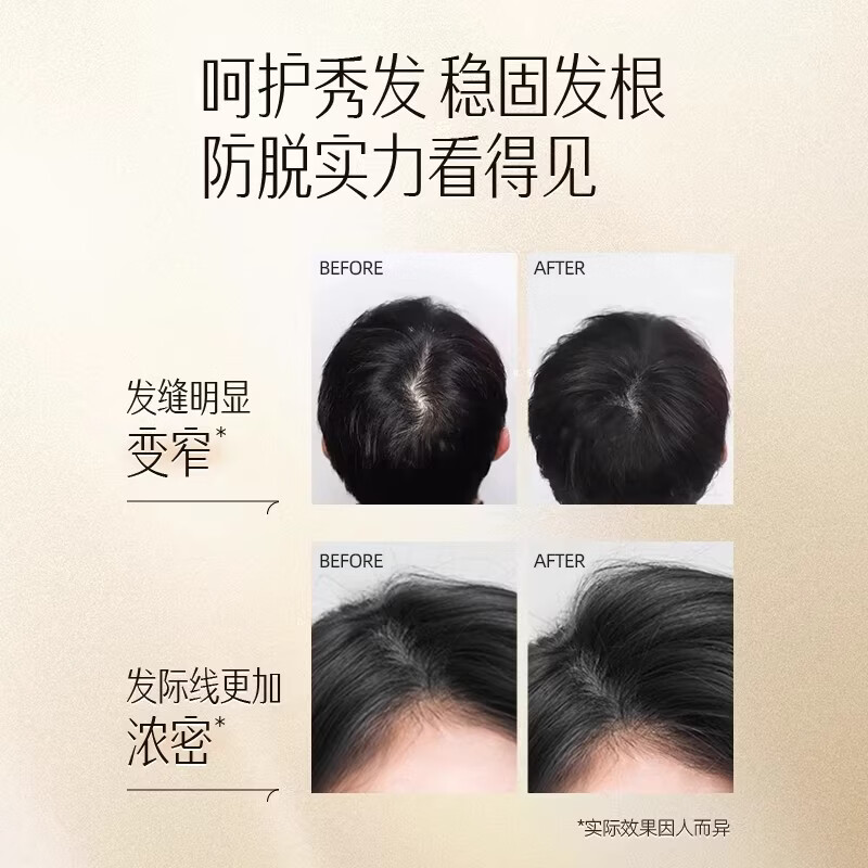 云南白药养元青洗发乳控油健发强韧防脱发清爽强根健发洗头膏洗发露500ml 【短发油头】控油止痒500ml