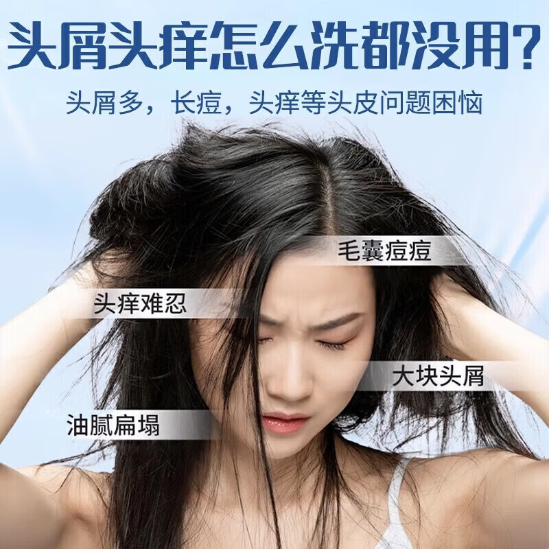 南京同仁堂二硫化硒洗发水去屑止痒控油持久蓬松毛洗发水金榜第1 二硫化硒洗发水3瓶特惠装
