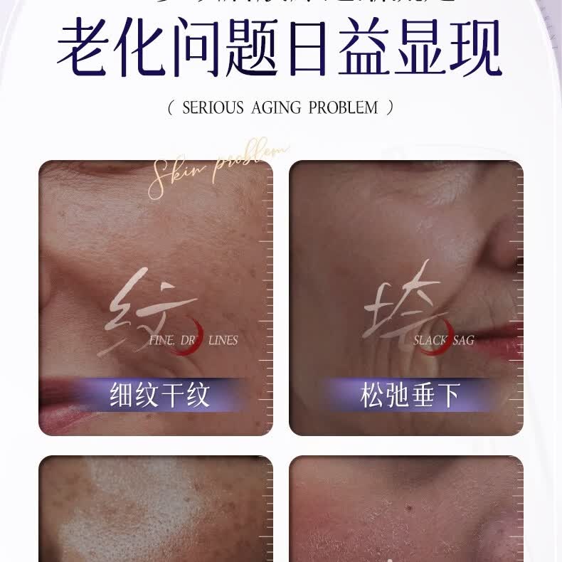 欧佩玻色因酵母弹力滋润柔肤霜50g滋润补水保湿面霜男女通用