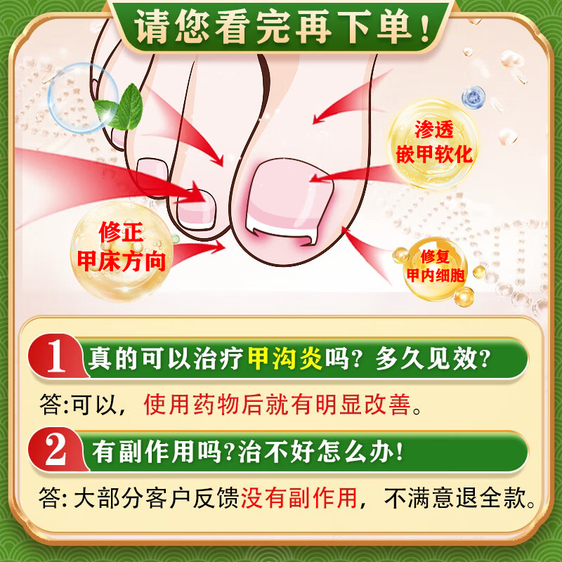 [华青]克霉唑乳膏 10g 2盒装 甲沟炎专用去药根部治脚趾甲往肉里长消肿止痛去肉芽治严重息肉外用消炎药【视觉特效】