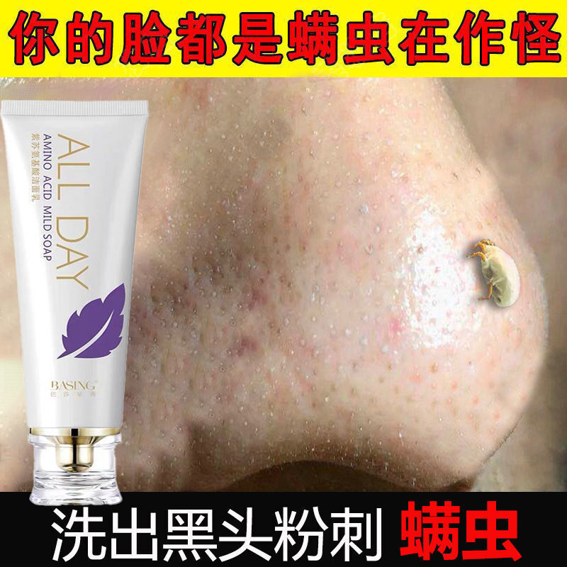 毛孔粗l大粉刺油皮闭口刺疏通毛孔氨基酸洗面奶除螨祛痘去l黑头控油