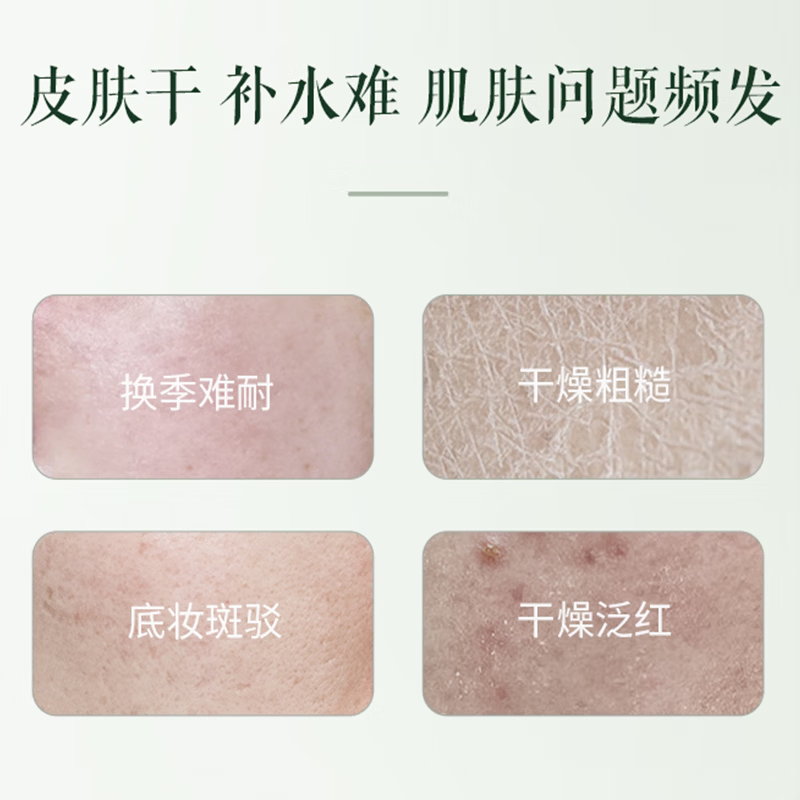 荟宝官方美肌精华膜力霜80g芦荟保湿补水滋润面霜男女护肤品润肤乳霜 美肌膜力霜80g