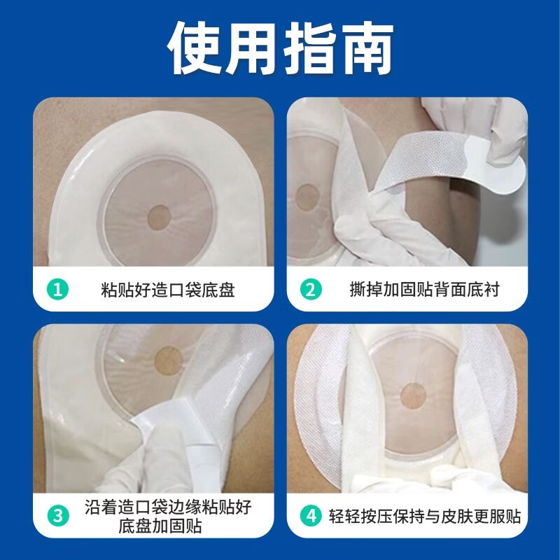 宇象造口袋弹力胶贴底盘加固医用压敏胶贴超薄水胶体水刺贴防翘边防漏 【1307水刺贴】20片/盒--经济实用 【买三送一/到手四份】囤货专选*店长推荐