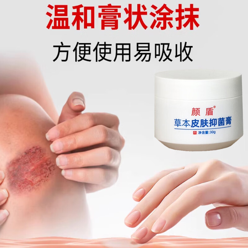 颜盾抑菌膏真菌感染草本乳膏外用软膏皮肤擦伤烫伤褥疮问题消肿止痒 一盒