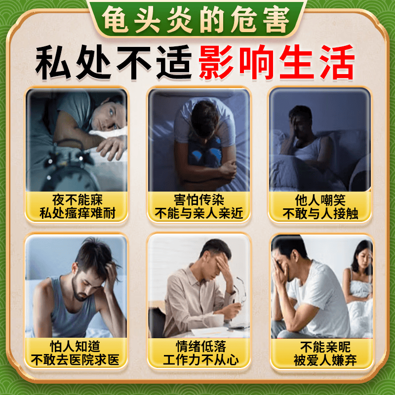 [华青]克霉唑乳膏 10g 1盒装 软男性私处龟头发炎白垢豆腐渣专用药膏治真菌感染红肿念珠菌霉菌包皮异味京大东大药房 皮肤用药 非处方药