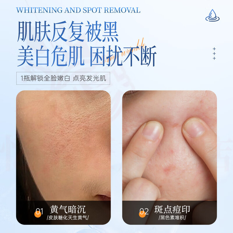 MRYU水悠季美白祛斑霜去黄褐斑雀斑淡化色斑滋润补水保湿提亮烟酰懒人 1瓶装 官方自售