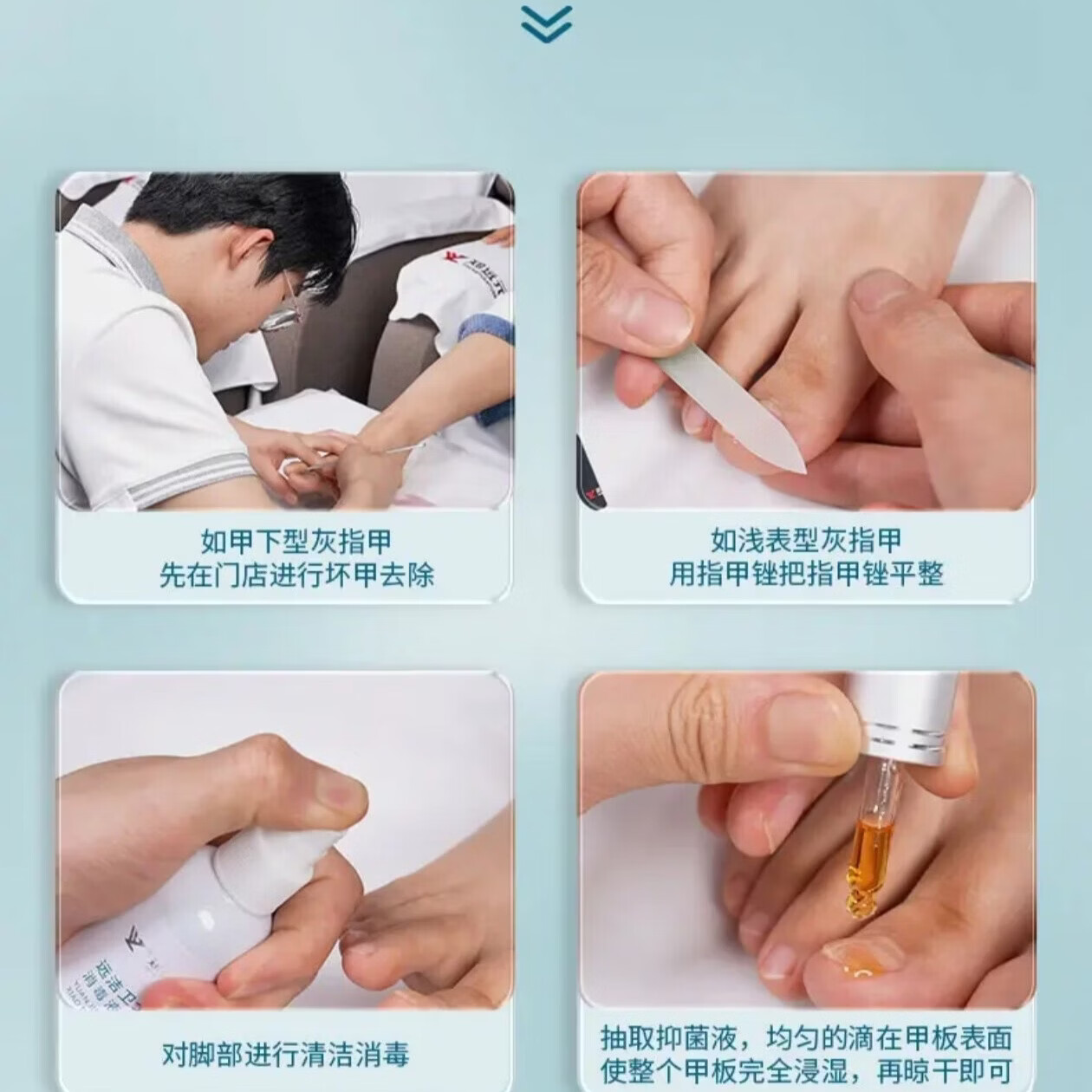 郑远元【门店同款】抑菌康灰指甲抑菌液搽剂杀菌脱甲膏新包 [坏钾抑菌]抑菌康抑菌液1瓶