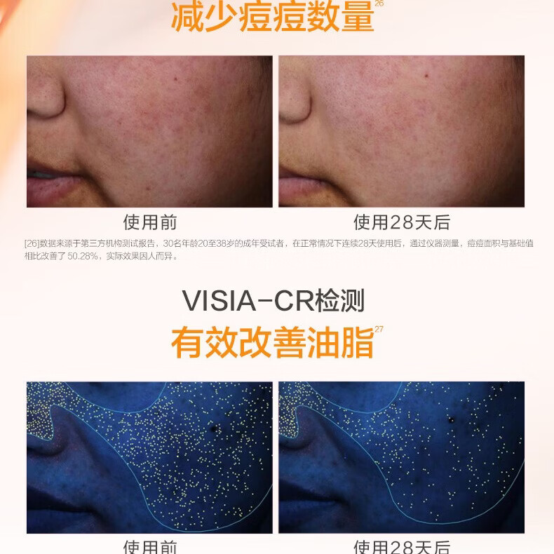 春夏积雪草特护冰玉膜舒缓修护柚果补水保湿紧致毛孔 木瓜冰玉膜(祛痘控油)