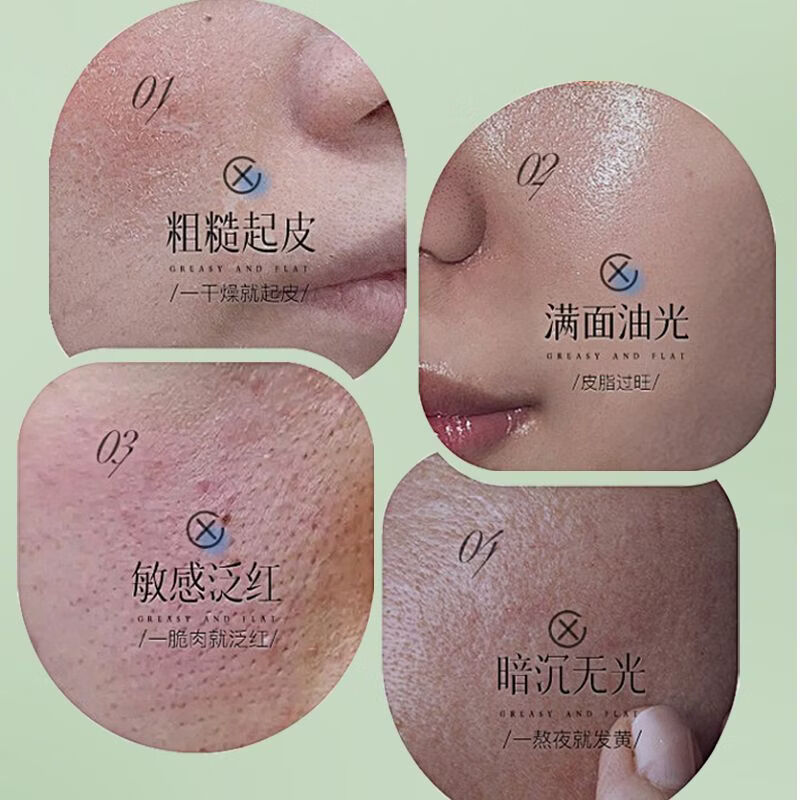 芮俏植物综合舒缓面霜滋润冬季深层补水保湿清爽屏障修护敏感肌护祛痘 【告别干痒红敏】植物综合舒缓霜*2支 30g