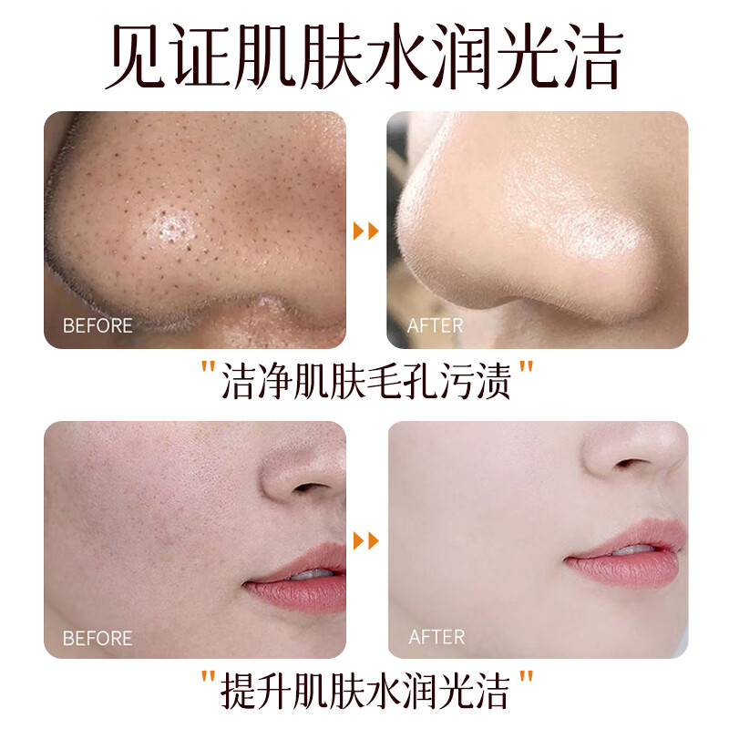 韩伦美羽焕颜撕拉面膜去黑头粉刺深层清洁收缩毛孔紧致保湿舒缓涂抹面膜 2支共 160g