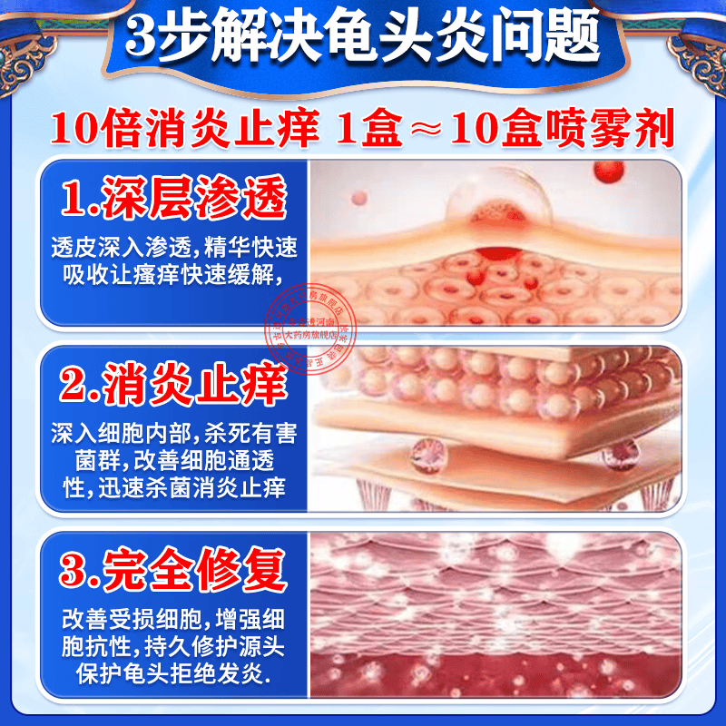 [华青]克霉唑乳膏 龟头瘙痒炎真菌感染京大东大药房龟头红肿红点瘙痒抗霉菌白垢豆腐渣私处男士皮肤专用药 10g 2盒装 【建议疗程装】