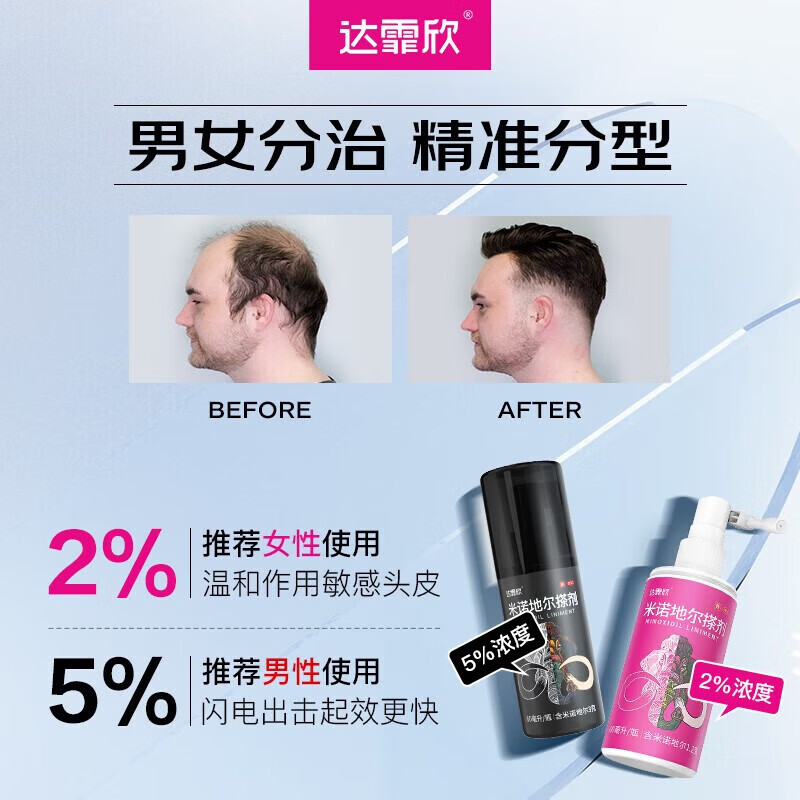 [达霏欣]米诺地尔搽剂 5%*60ml 2瓶装 5%浓度生发增发液喷雾育发液男防脱发严重脱发秃发治疗脱发斑秃防脱育发 咨询客服，赠好礼