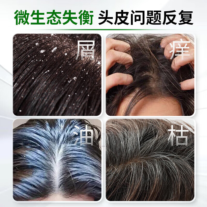 北京同仁堂二硫化硒去屑洗发水控油蓬松止痒洗头膏去头皮屑洗发露 【1瓶体验装】300ml/瓶