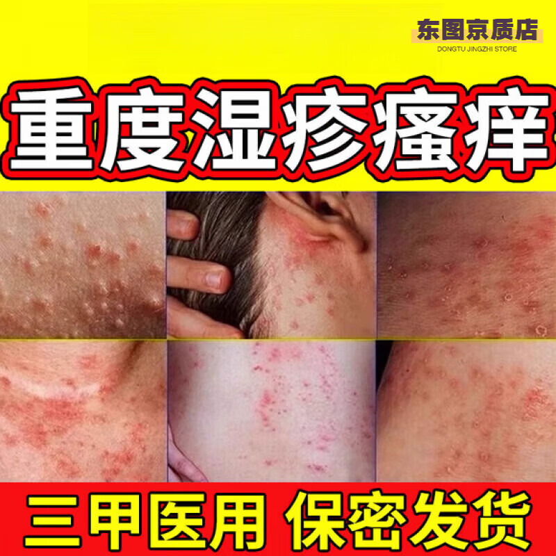 熏姿颜妙奈花皮肤湿疹止痒去外用顽固慢性皮炎抑菌膏湿痒皮肤抑菌 三盒装 官方授权旗舰店