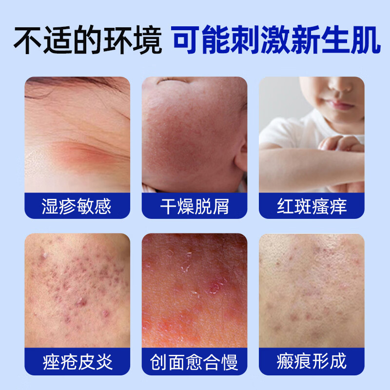 敏爸爸医用重组人源三型胶原蛋白皮肤修复护理膜 皮肤修复护理膜1支装