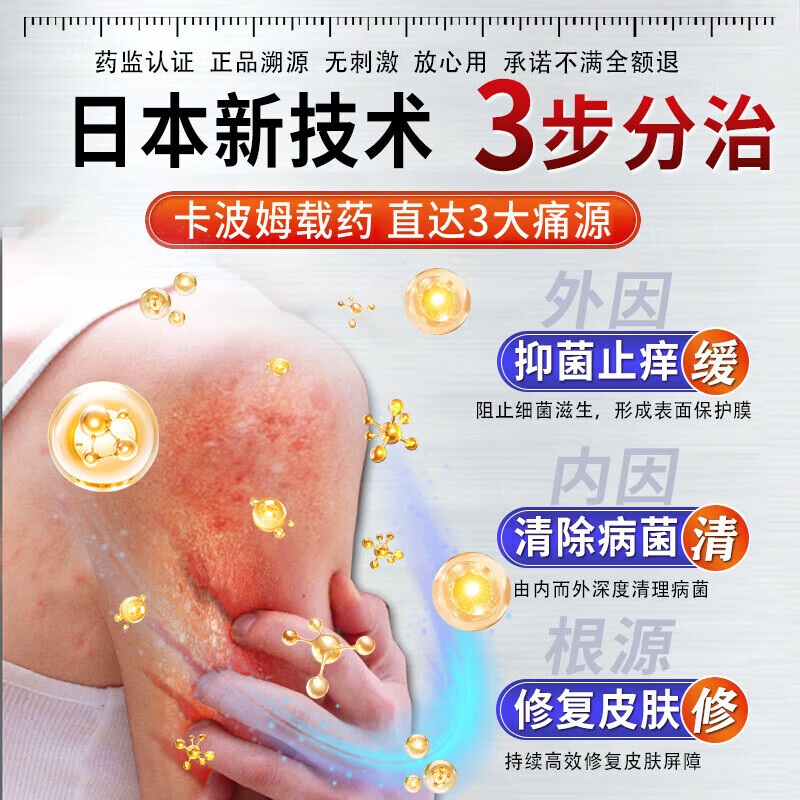 伊藤薬制日本炉甘石抑菌止痒皂全身瘙痒湿痒湿诊真菌感染止痒皂全身体适用 一盒【日本进口】炉甘石抑菌止痒膏 炉甘石软膏婴儿儿童止痒乳膏湿疹热疹