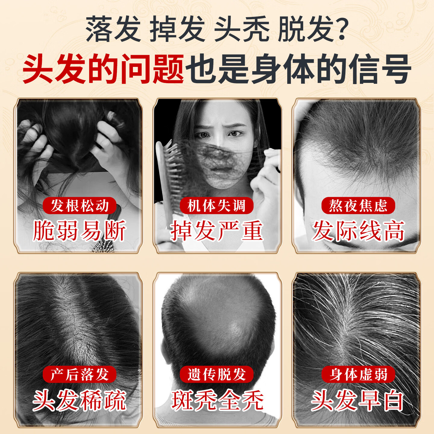 [仁和]固肾生发丸 2.5g*27袋 2盒装 固肾养血，益气祛风。用于斑秃、全秃、普秃及肝肾虚引起的脱发。 轻度脱发|生发疗程