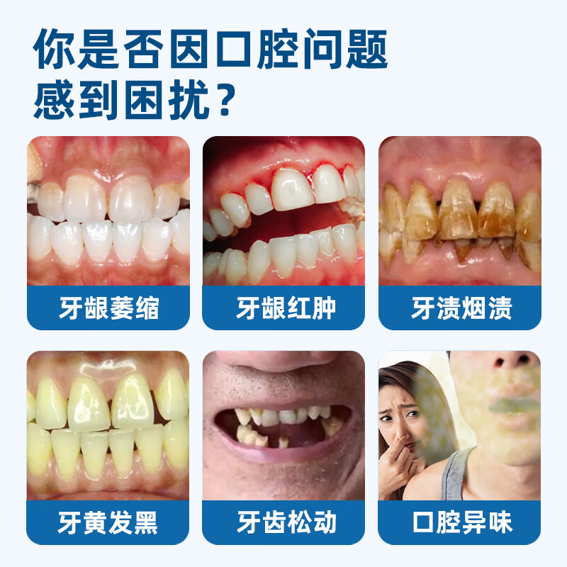 李时珍牙科分离剂牙龈萎缩牙齿松动固齿修复再生牙周炎敏感肿痛口臭专用 3盒疗程装【官方旗舰】93%顾客选择