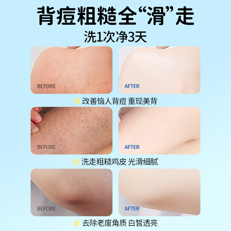袋鼠杰克青少年沐浴露 温和洁净 舒润保湿儿童沐浴露控油爽身沐浴乳12岁+ 青少年舒润沐浴露520ML（自由清香）+沐浴露20ml 青少年沐浴露热销榜Top1